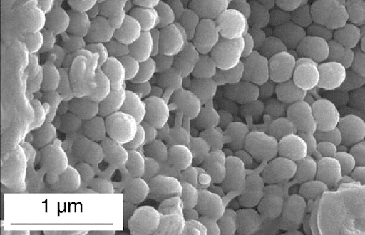 common opal electrons